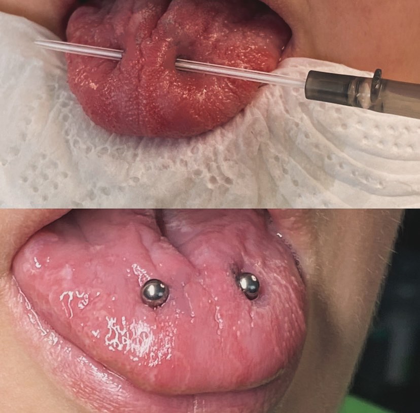 Advanced Tongue Piercing